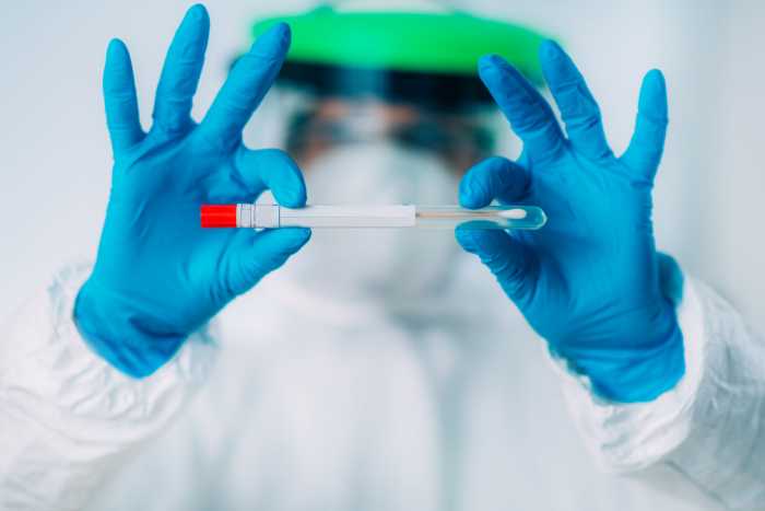 RT PCR test kit