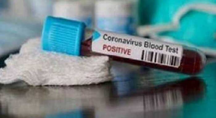 cuba sees 877 covid 19 cases no death
