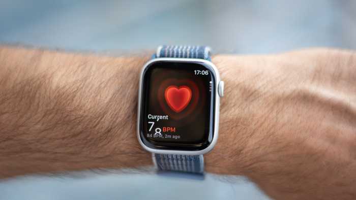 Apple Watch Series 10