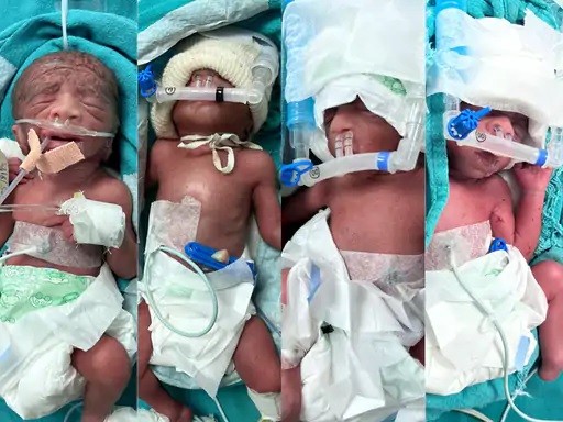 Woman Gives Birth to Quadruplets Through Normal Delivery