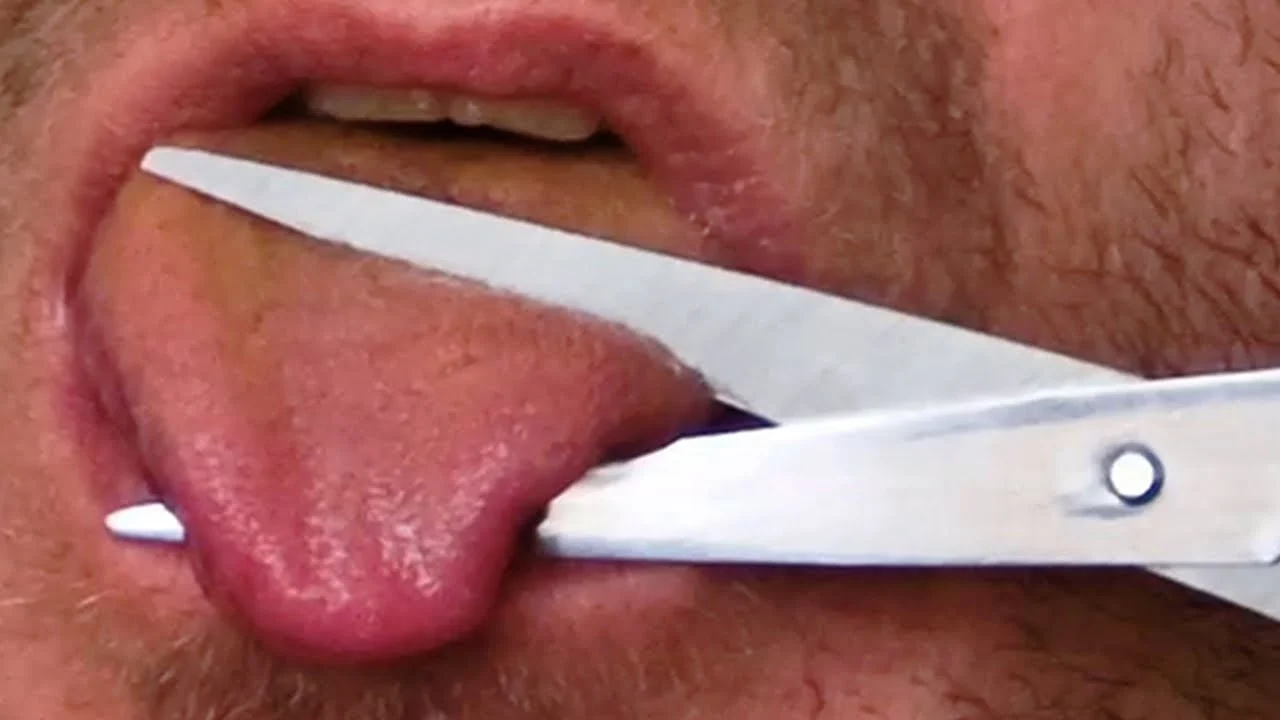 Cutting Off Tongue