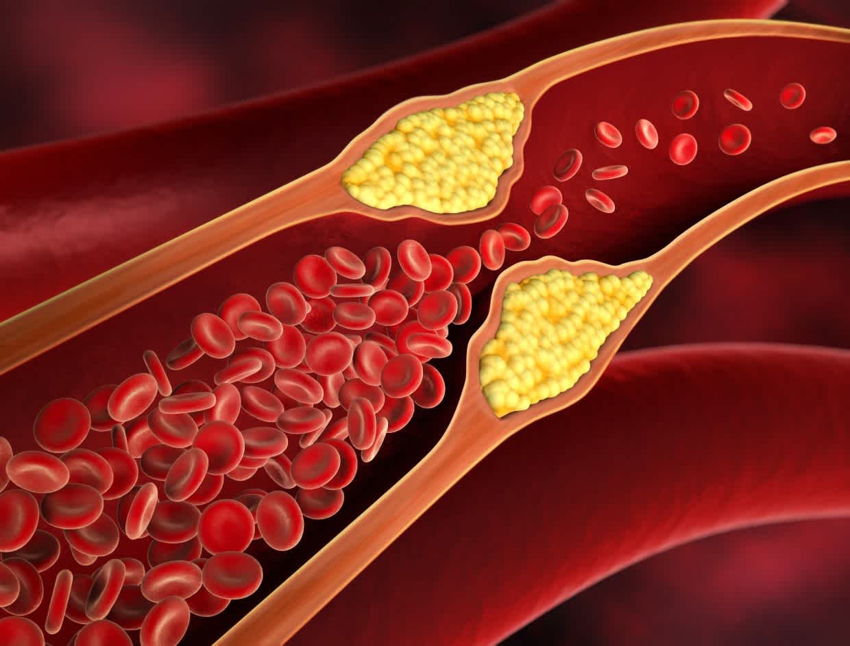 Daily Habits Can Raise Cholesterol — Ayurveda Explains How to Control It Naturally | Udaipur Kiran