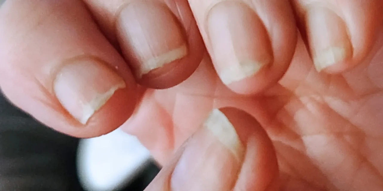 Nails Reflect Your Health