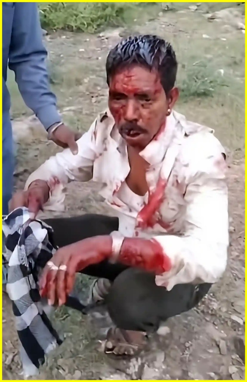 Panther attacks five villagers in Udaipur’s Umarda Kheda, four seriously injured